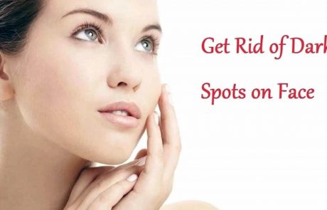 Age Spot Removal