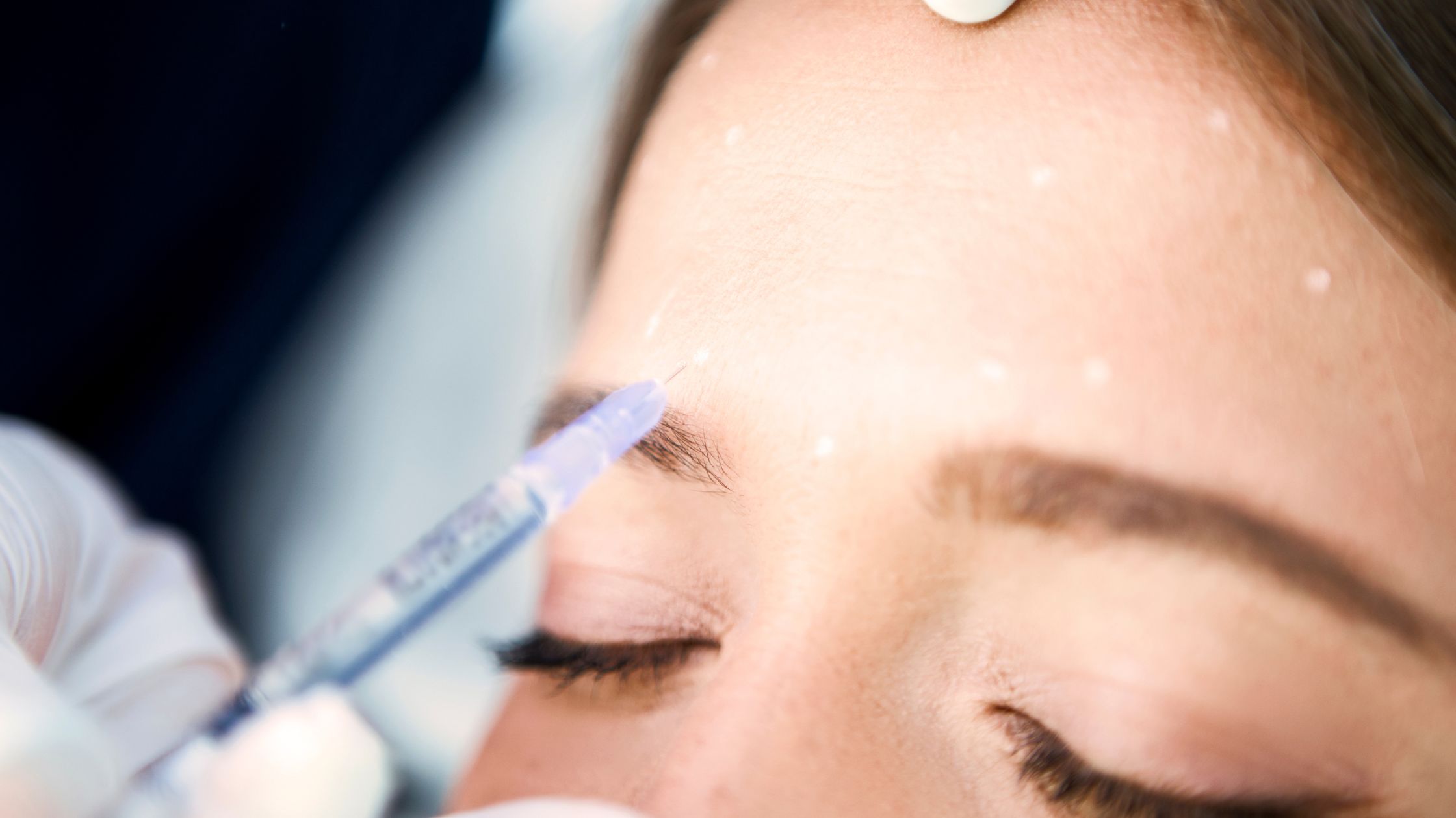 BOTOX Injections