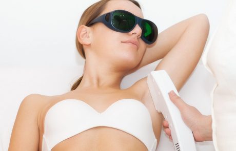 Laser Hair Removal