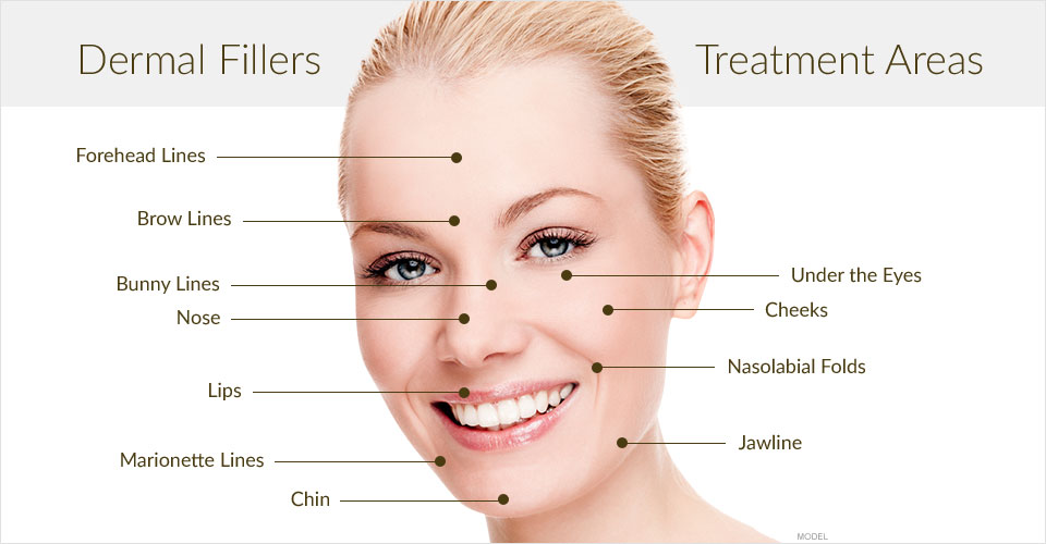 Facial Dermal Fillers