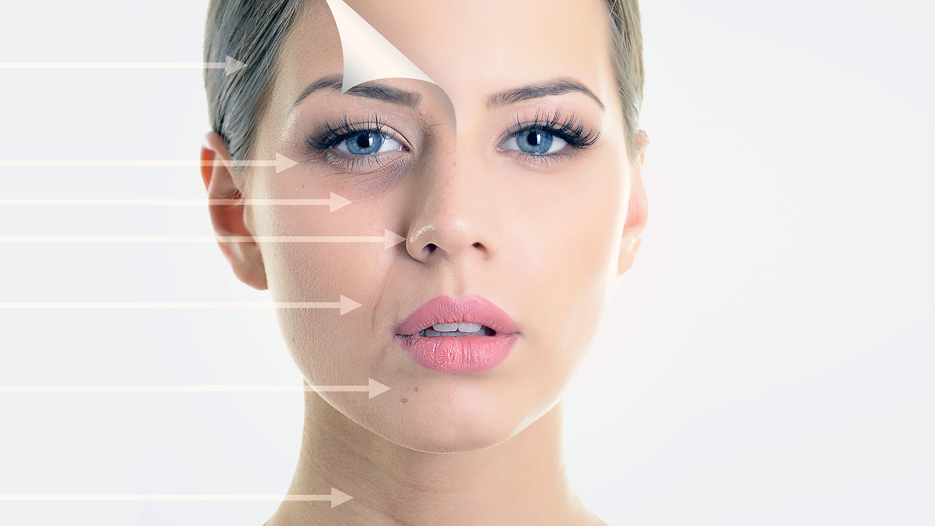 What are dermal fillers and how do they work