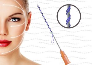 Thread Lift for face