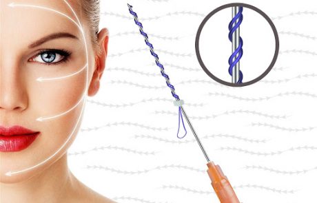 Thread Lift for face
