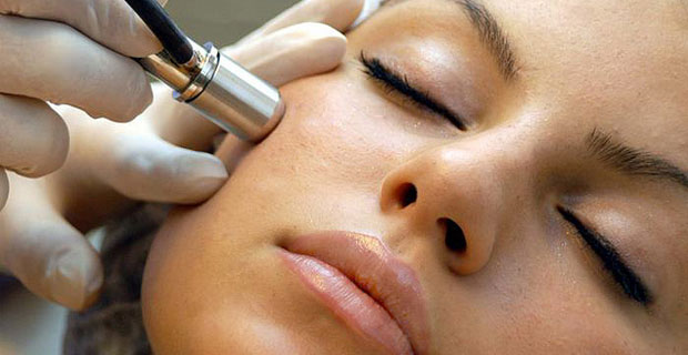 things to know before having laser treatment for your scar